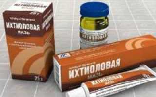 Как использовать ихтиоловую мазь при прыщах