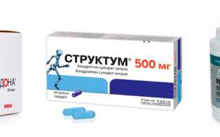 Перечень лекарств от артроза суставов: список эффективных препаратов