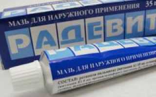 Мазь от морщин Радевит