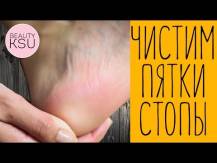 Embedded thumbnail