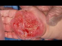Embedded thumbnail
