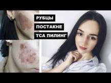 Embedded thumbnail