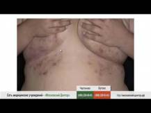 Embedded thumbnail