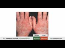 Embedded thumbnail