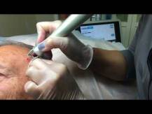 Embedded thumbnail