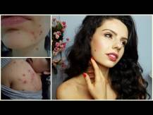Embedded thumbnail
