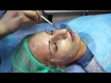 Embedded thumbnail