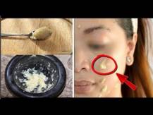 Embedded thumbnail