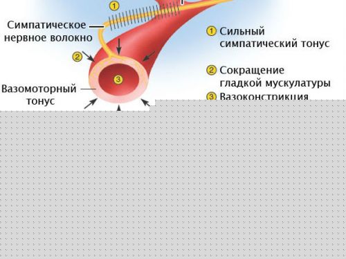 Спазм сосудов сетчатки