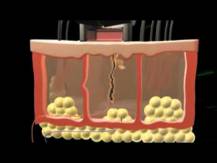 Embedded thumbnail