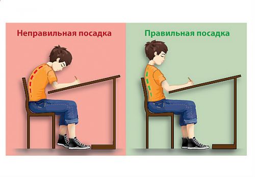 Правильная осанка