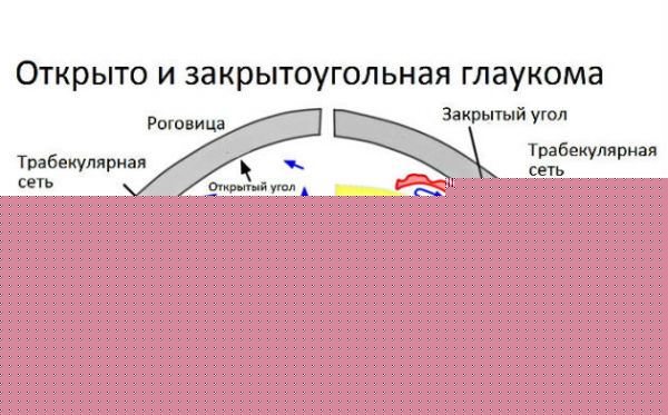 Глаукома