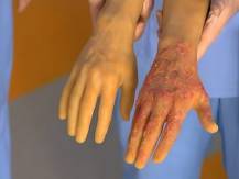Embedded thumbnail