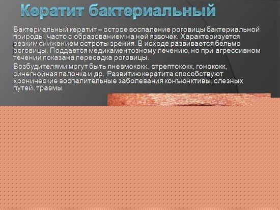 Бактериальный кератит