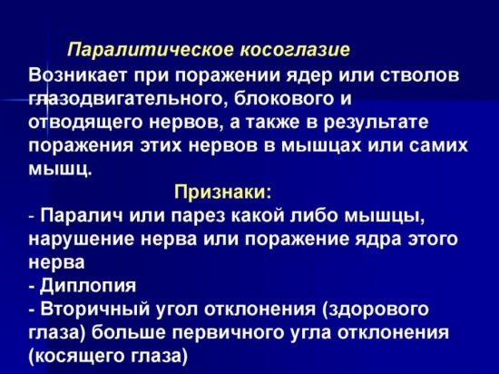 Паралитическое косоглазие