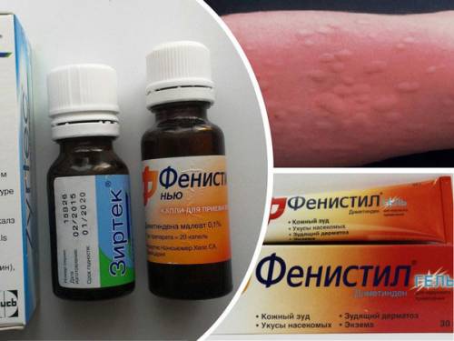 Фенистил