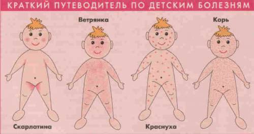 Сыпь при инфекционных заболеваниях Сыпь при инфекционных заболеваниях