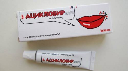 Ацикловир
