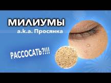 Embedded thumbnail