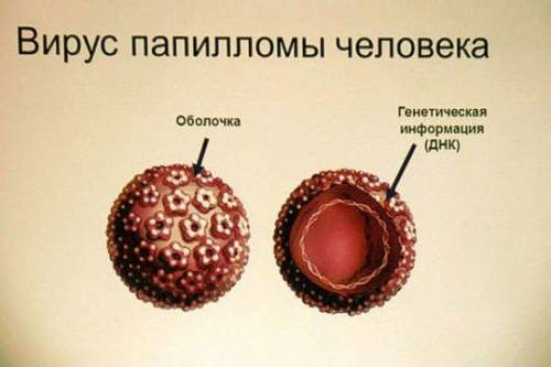 Вирус папилломы человека