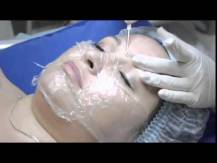 Embedded thumbnail