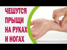 Embedded thumbnail