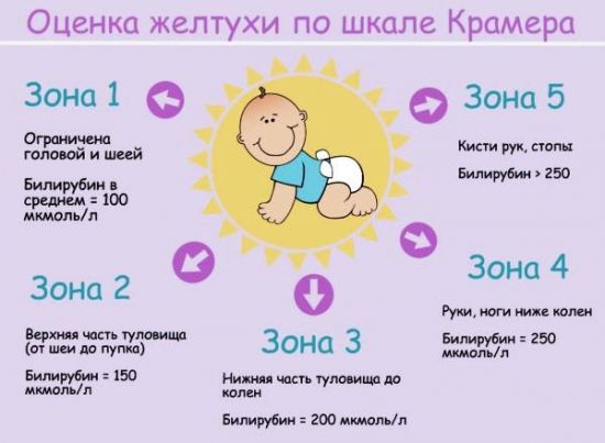 Оценка желтухи у новорожденного